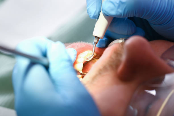Best Emergency TMJ Treatment in Remgton, IN